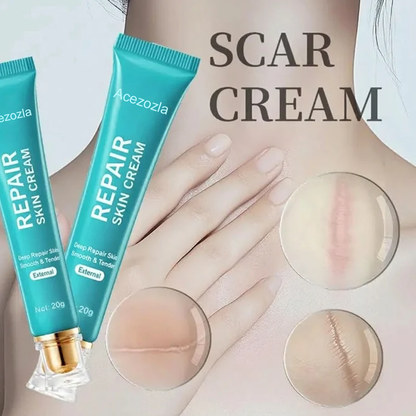 NEYEROS® Repair Scar Cream-Powerful repair, without leaving any trace