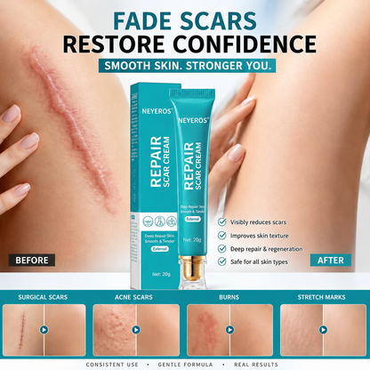 NEYEROS® Repair Scar Cream-Powerful repair, without leaving any trace
