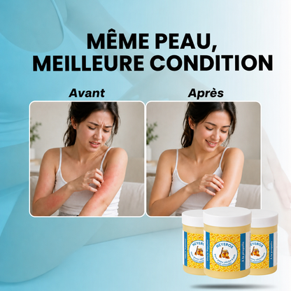 Crème Apaisante à la Propolis
