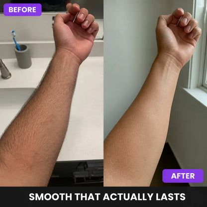 Ventra Men Premium Hair Removal Spray